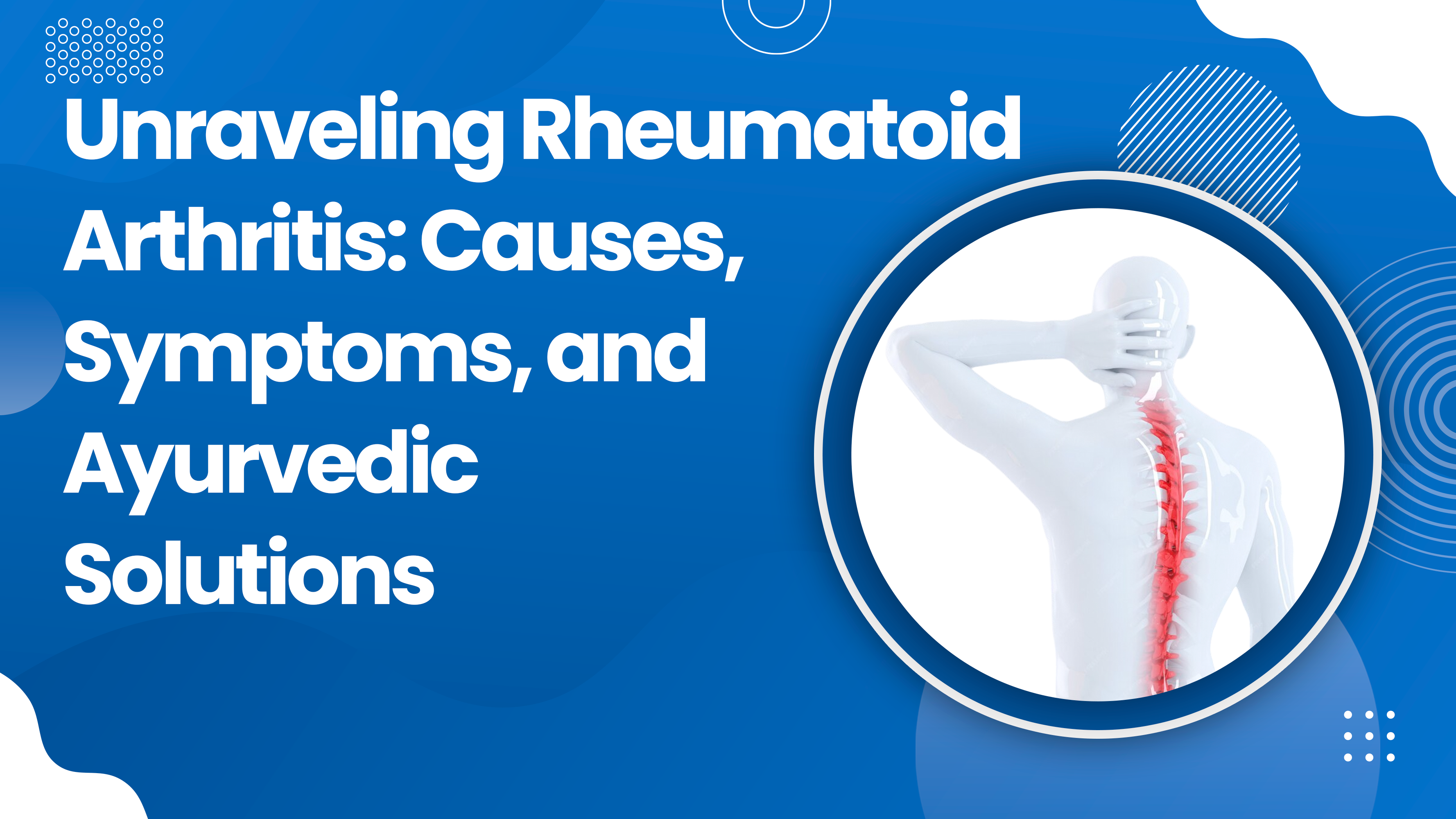 Unraveling Rheumatoid